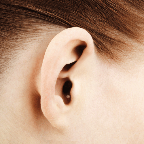 Im-Ohr-Hörsysteme