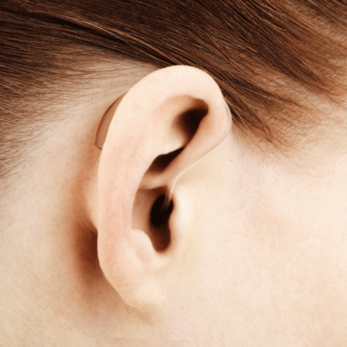 Hinter-dem-Ohr-Hörsysteme
